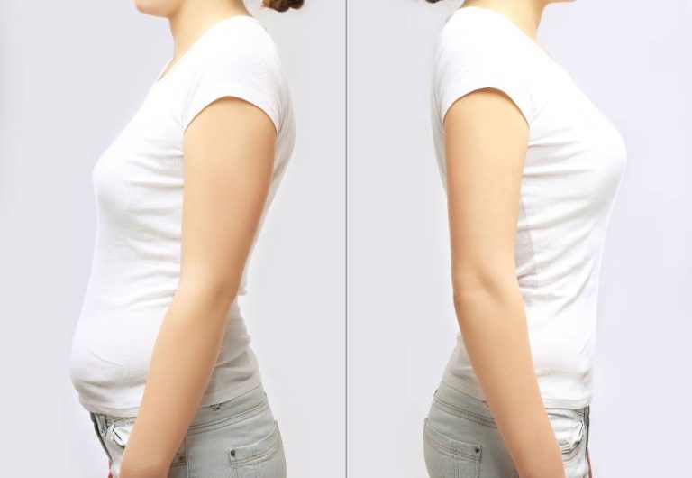 Donna che mostra due posture: a sinistra una postura scorretta e a destra una postura corretta